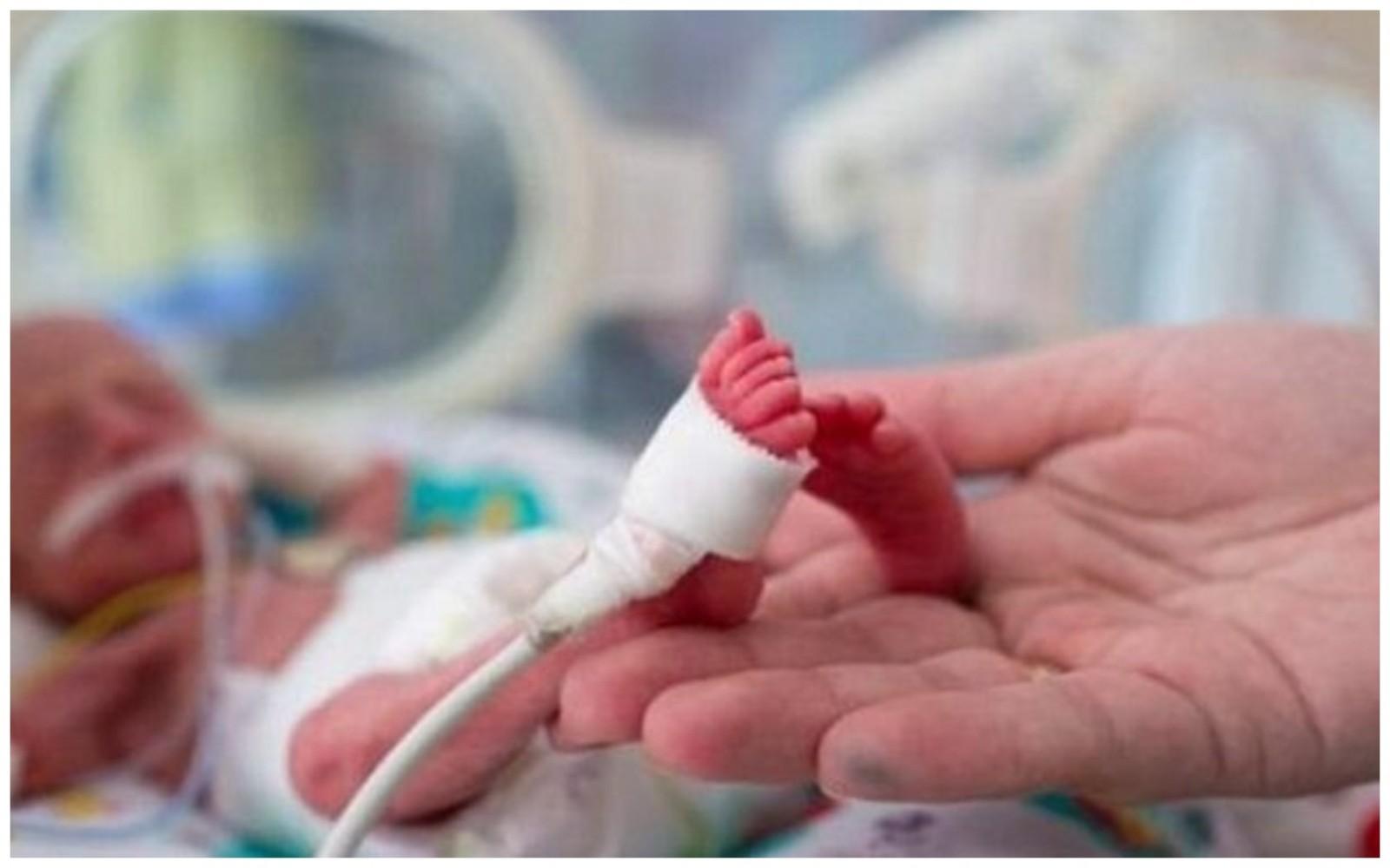 В одній з лікарень Київщини виходжують новонароджене немовля з вагою 835 грамів