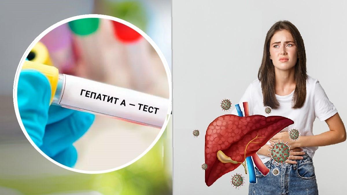 Гепатит А уже на Київщині – як від нього вберегтися