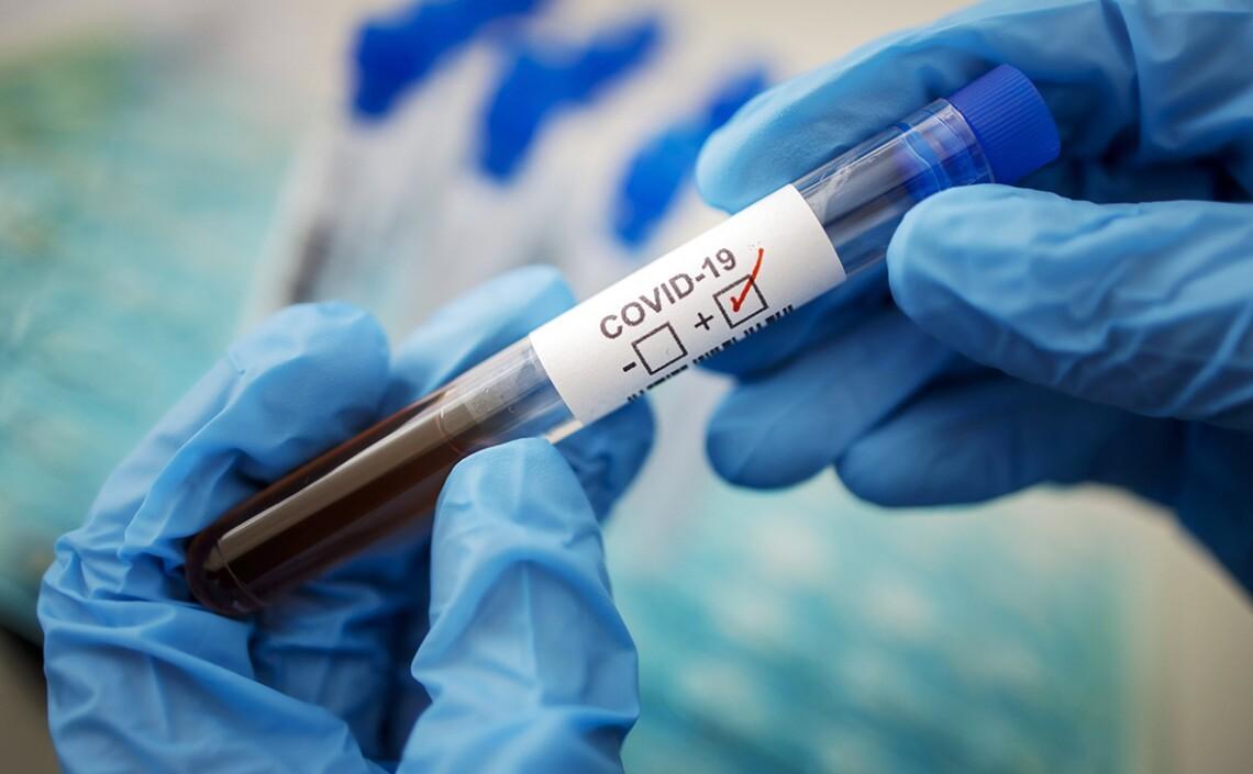 У Києві зростає кількість випадків COVID-19 серед дітей: медики б’ють на сполох