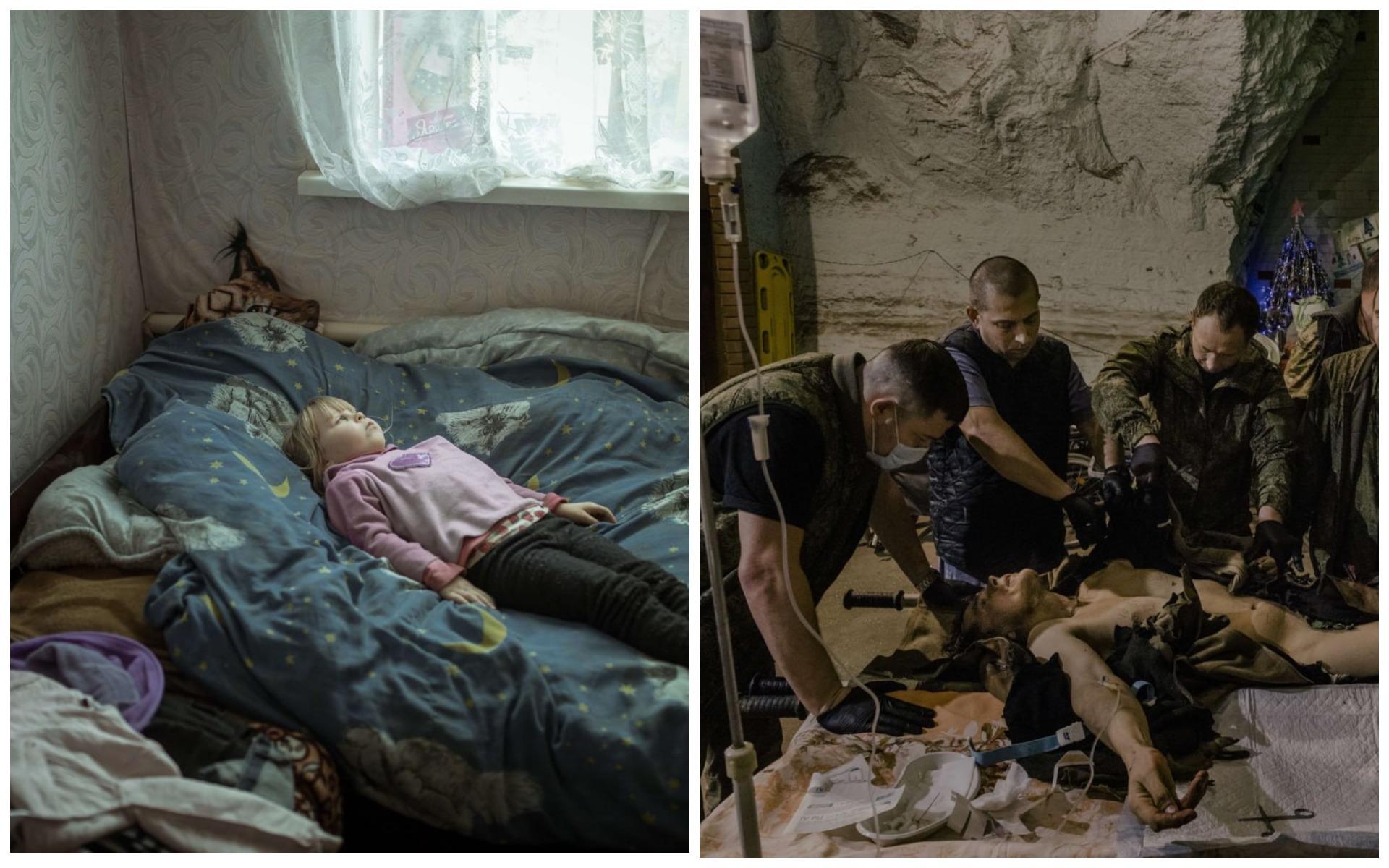 МЗС України обурений результатами World Press Photo, на яких травмована війною українська дитина і окупант