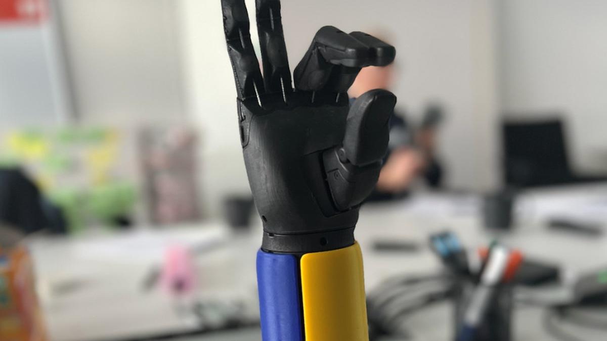 Уряд Франції профінансує створення мікроклініки з протезування для жителів Київщини