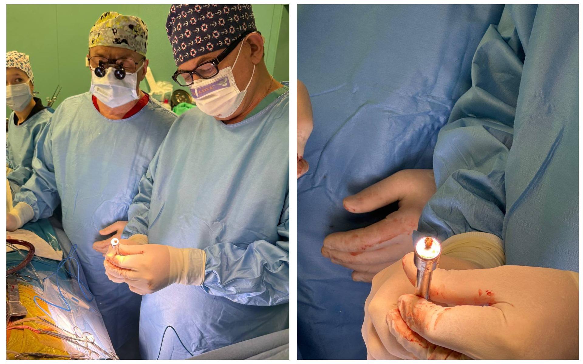 Лікарі провели надскладну операцію: з серця пораненого військового видалили уламок