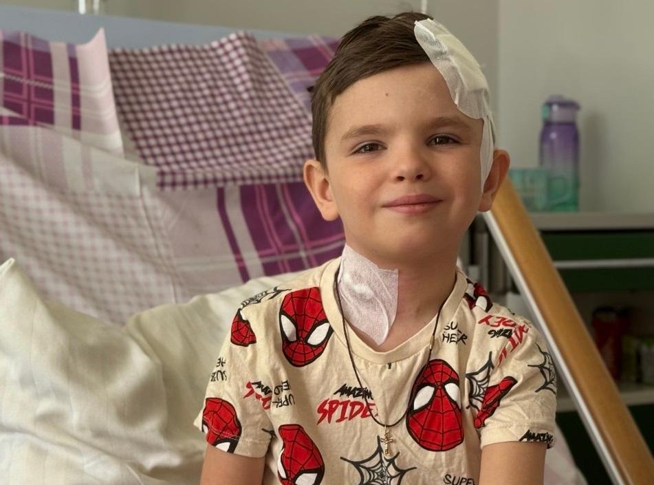 Одна з найскладніших операцій: львівські лікарі позбавили важкої епілепсії 6-річного хлопчика