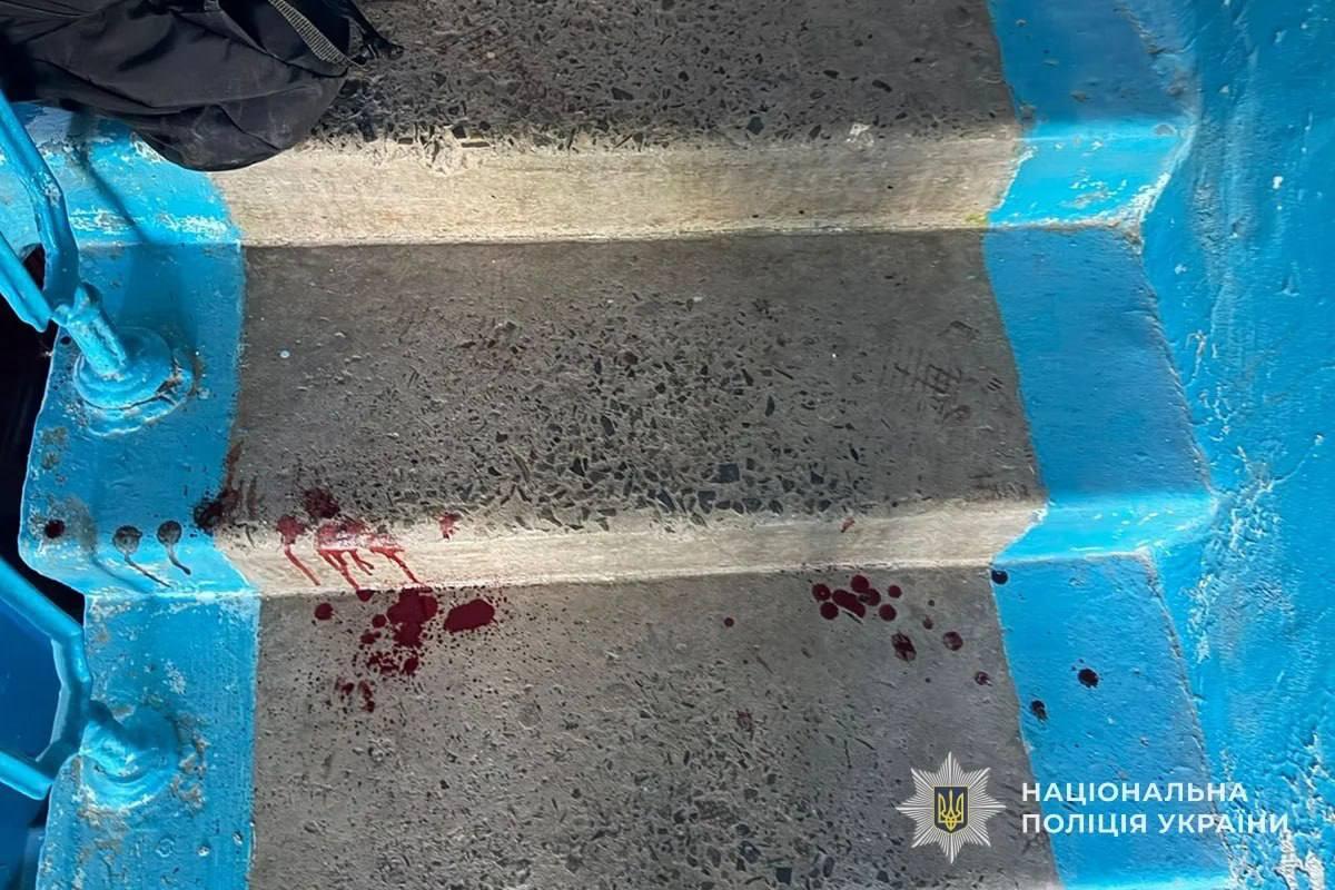 У Тернополі школярка вдарила однокласницю ножем – дівчина в реанімації