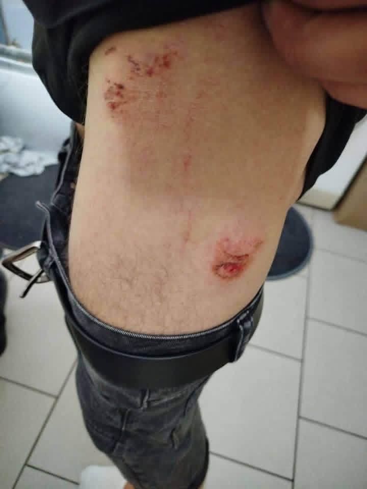 У Польщі після конфлікту через музику побили трьох українців: нападників розшукують